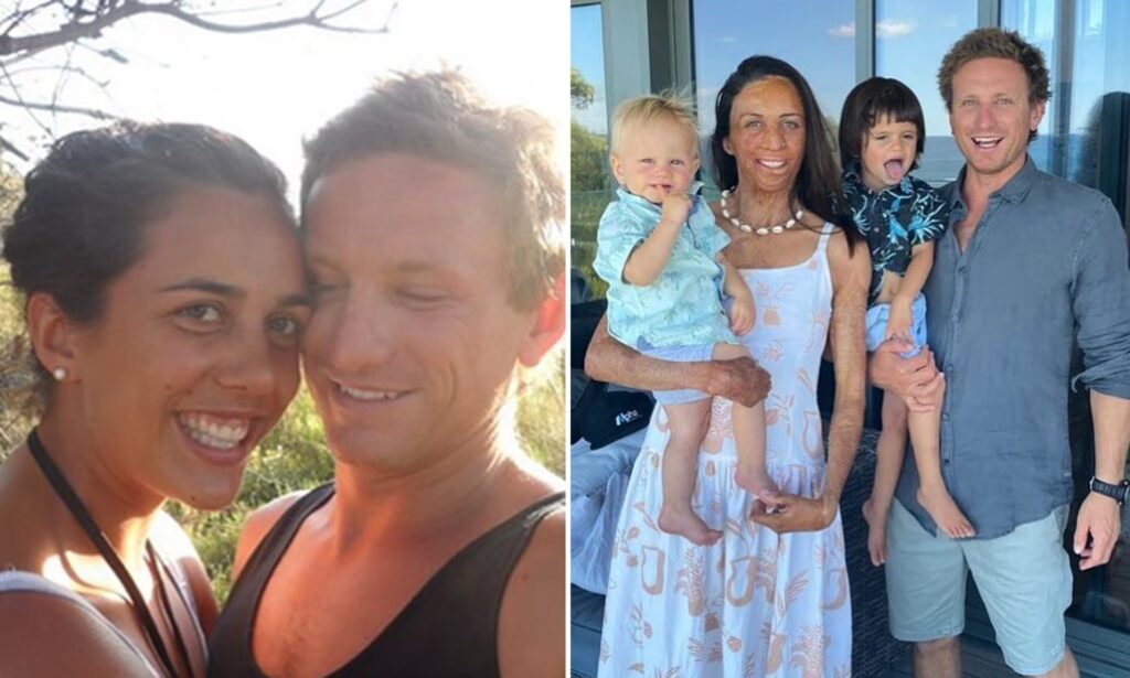 L’incroyable histoire de Turia Pitt, le mannequin sportif qui inspire des milliers de personnes